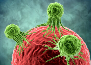 මහබඩවැල ආශ්‍රිත පිළිකාව හඳුනාගන්නේ කොහොමද?