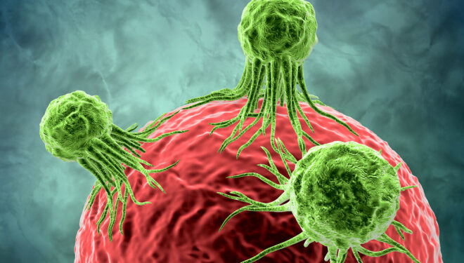 මහබඩවැල ආශ්‍රිත පිළිකාව හඳුනාගන්නේ කොහොමද?