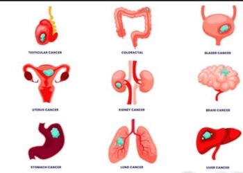 පිළිකාව තියෙන තැන අනුව රෝග ලක්ෂණ දැනගනිමු