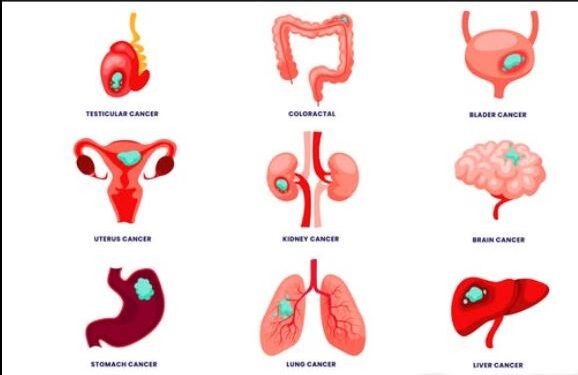 පිළිකාව තියෙන තැන අනුව රෝග ලක්ෂණ දැනගනිමු