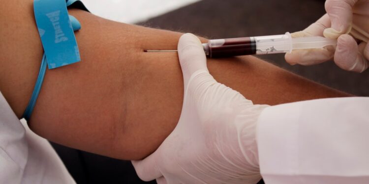 රෝග ලක්ෂණ මතුවීම ප්රමාදයි – දිනපතා පුද්ගලයින් පස් දෙනෙකු මියයාමේ අවදානමක්