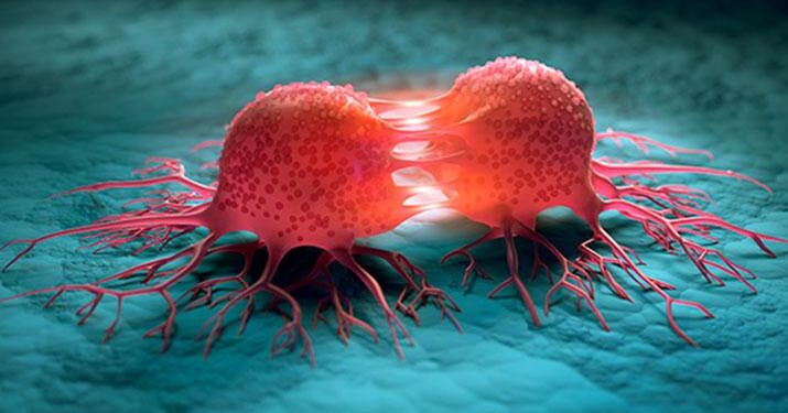 පිළිකා රෝග වාර්තා වීම් ඉහළට – මරණයට පත්වන සංඛ්යාවත් වැඩියි