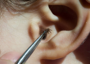 කනට සතෙක් ගියොත් කරන්නෝන දේ