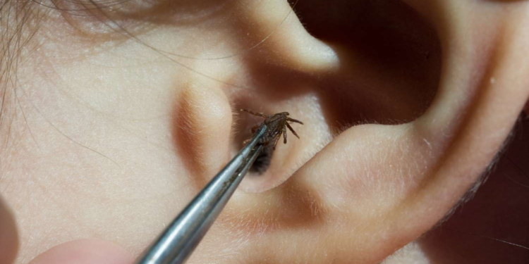 කනට සතෙක් ගියොත් කරන්නෝන දේ