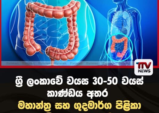 ශ්‍රී ලංකාවේ වයස 30-50 වයස් කාණ්ඩය අතර  මහාන්ත්‍ර සහ ගුදමාර්ග පිළිකා සීඝ්‍රයෙන් ඉහළට