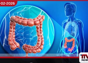 ශ්‍රී ලංකාවේ වයස 30-50 වයස් කාණ්ඩය අතර  මහාන්ත්‍ර සහ ගුදමාර්ග පිළිකා සීඝ්‍රයෙන් ඉහළට