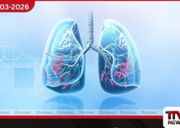 2035 වන විට  ක්ෂය රෝගය  මෙරටින් තුරන් කිරීමේ  ජාතික මෙහෙයුම ඇරඹෙයි