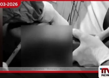 බදුල්ල මහ රෝහලෙන්  විස්මිත සැත්කමක්