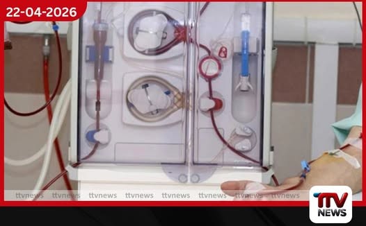 රුපියල් මිලියන 889ක වියදමින්  පෙරිටෝනියල් ඩයලයිසිස් ද්‍රාවණ  සැපයීමට අනුමැතිය