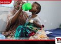 ඉරාන යුද්ධය නිසා සෝමාලියාවේ  මන්දපෝෂණයෙන් පෙළෙන දරුවන්  මරණයේ අභියසට