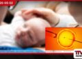 දරුවන් නොමැති යුවළ සඳහා  නව බලාපොරොත්තුවක්  කෘත්‍රිම බුද්ධියෙන්  වඳභාවයට විසඳුම්