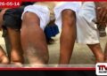 මෙරටින් බරවා රෝගීන්  68 ක් හඳුනාගැනේ