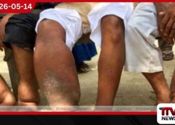 මෙරටින් බරවා රෝගීන්  68 ක් හඳුනාගැනේ