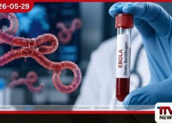 ඉබෝලා වෛරස් ව්යාප්තිය පාලනයට අමෙරිකාවෙන් දැඩි පියවර අප්රිකානු රටවල් 3ක සංචාරකයින්ට විශේෂ සෞඛ්ය පරීක්ෂණ