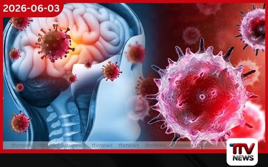 මෙනින්ජයිටීස් රෝග ව්යාප්තියක්: