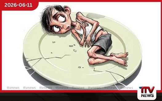 මෙරට අවුරුදු 5ට අඩු දරුවන්ගේ මන්දපෝෂණය වැඩිම ඌව පළාතේ අධිපෝෂණයත් ඉහළ යාමේ ප්රවණතාවක්