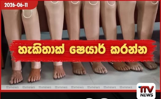බෞද්ධ මහා සම්මේලනයෙන් පාද ආබාධිත ශ්රී ලාංකිකයන් වෙනුවෙන් නොමිලේ කෘත්රිම පාද 500ක්