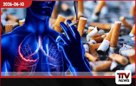 දිනකට සිගරට් 10 බැගින් බොන අයට වැළඳෙන ලෙඩ මෙන්න: