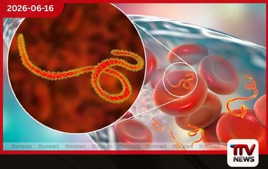 කොංගෝවේ ඉබෝලා වෛරසය පෙර නොවූ විරූ ලෙස ව්යාප්ත වෙයි
