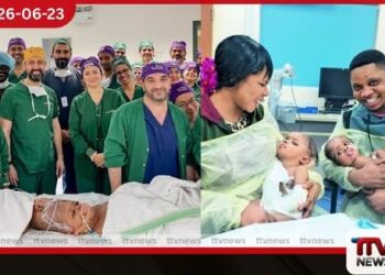 හිසෙන් බද්ධ වූ නිවුන් දැරියන් දෙදෙනෙකු කෘත්රිම බුද්ධිය ආධාරයෙන් සාර්ථකව වෙන් කෙරේ