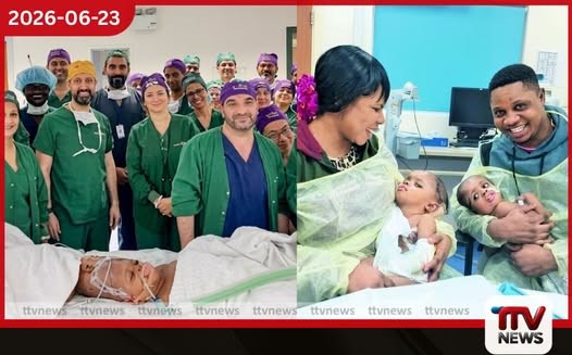 හිසෙන් බද්ධ වූ නිවුන් දැරියන් දෙදෙනෙකු කෘත්රිම බුද්ධිය ආධාරයෙන් සාර්ථකව වෙන් කෙරේ