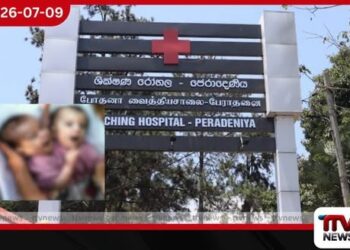 ලොව පළමු වතාවට බද්ධ නිවුන් දරුවන්ට වකුගඩුවක් බද්ධ කර වෙන් කළ විස්මිත සැත්කම පේරාදෙණිය රෝහලෙන් සාර්ථකයි!