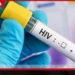 කොළඹ සහ ගම්පහ ප්රදේශවල HIV ආසාදිතයන් ඉහළට සෞඛ්ය අංශවලින් අනතුරු ඇඟවීමක්…