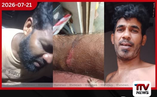 ජුනි මාසයේ උද්ධමනය ඉහළට