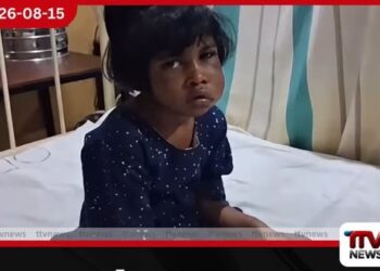 දරුණු ලෙස හිංසනයට ලක් වූ දැරියට ශල්යකර්මයක් නිර්දේශ කෙරේ