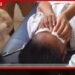 තණකොළ කපන යන්ත්‍රයෙන් විසිවූ දෙයක් වැදී