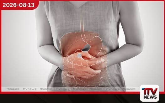 කෘත්රිම ආහාර නිසා බඩවැල් ආශ්රිත රෝගීන් ඉහළට