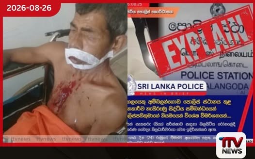 ඒ තාත්තා බීලා හිටියේ, අපි ගැහුවේ නෑ.. දුවද්දී වැටිලා තුවාල වුණේ..