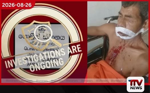 තාත්තාට ලේ එනකම් පහරදුන්නා කියන අම්බලන්ගොඩ උප පොලිස් පරීක්ෂකට ස්ථාන මාරුවක්!