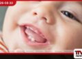 දරුවන්ගෙන් අඩකට මුඛ රෝග…