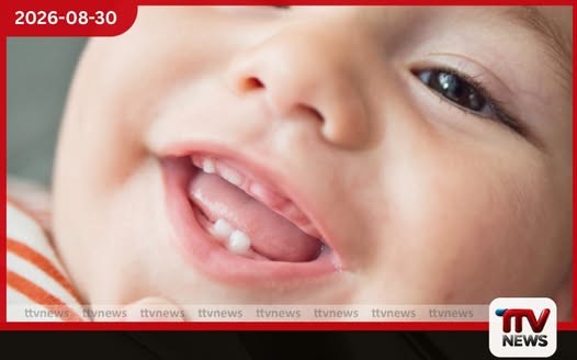 දරුවන්ගෙන් අඩකට මුඛ රෝග…